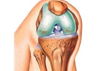 The main cause of knee arthritis