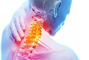 Symptoms of cervical joints and nutritional rules for disease