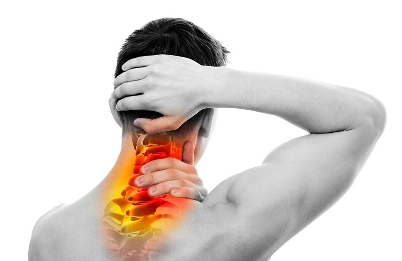 neck pain due to osteoarthritis