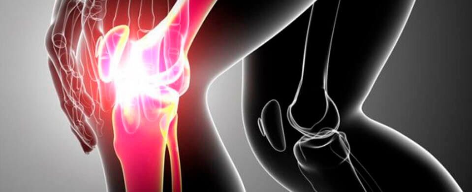 knee pain photo 4