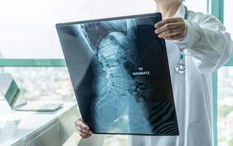 An X-ray is an essential diagnostic method if your back is painful